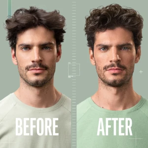 FORMING_CREAM_GEL_BeforeAfter.webp
